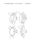 Pharmaceutical Delivery Device and Method for Providing Ocular Treatment diagram and image