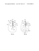 Needle Cannula Containing Medicament diagram and image