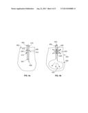 Needle Cannula Containing Medicament diagram and image