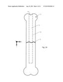 Drug Eluting Insert for Implantable Body diagram and image