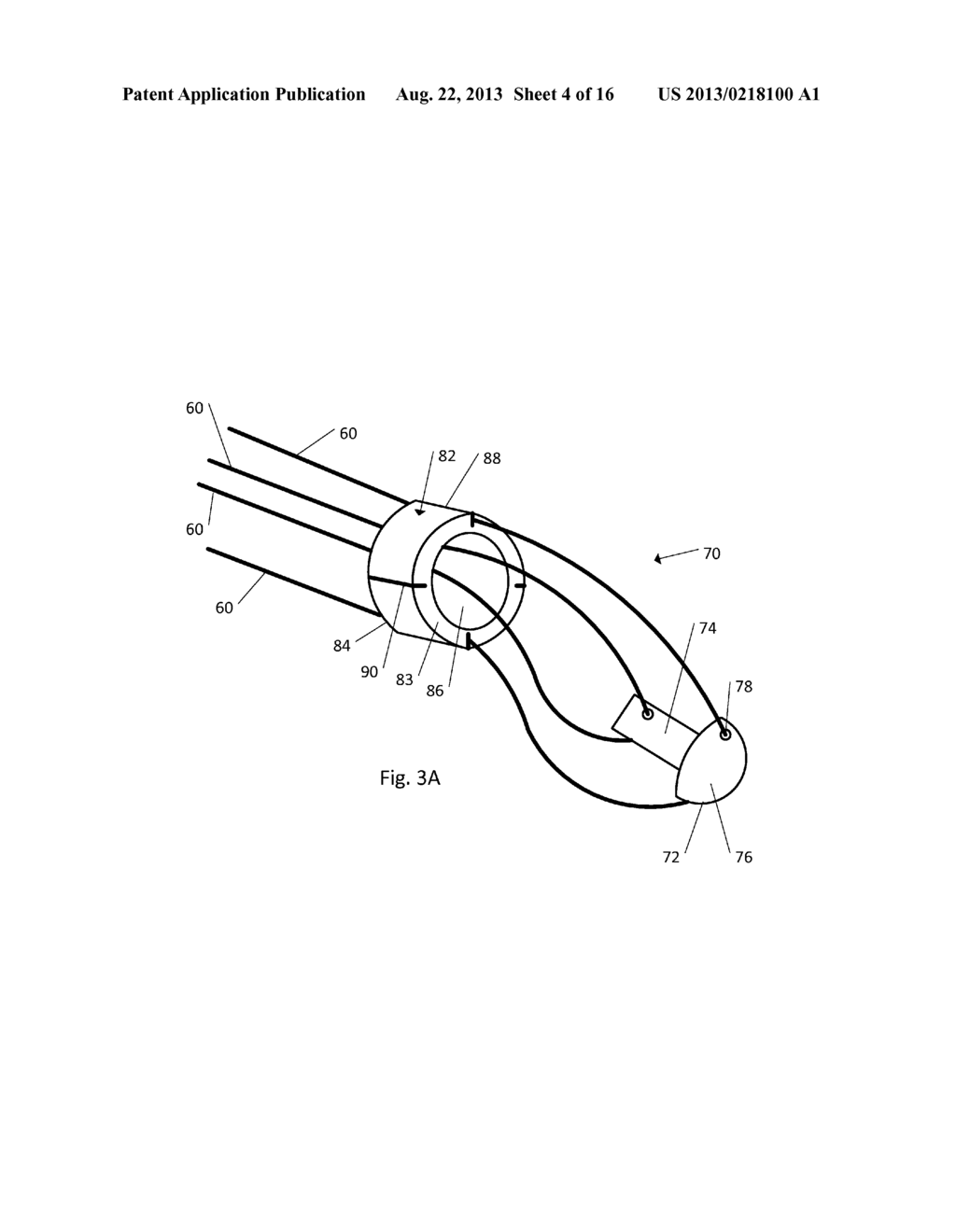 Drug Eluting Insert for Implantable Body - diagram, schematic, and image 05