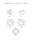 Drug Eluting Insert for Implantable Body diagram and image