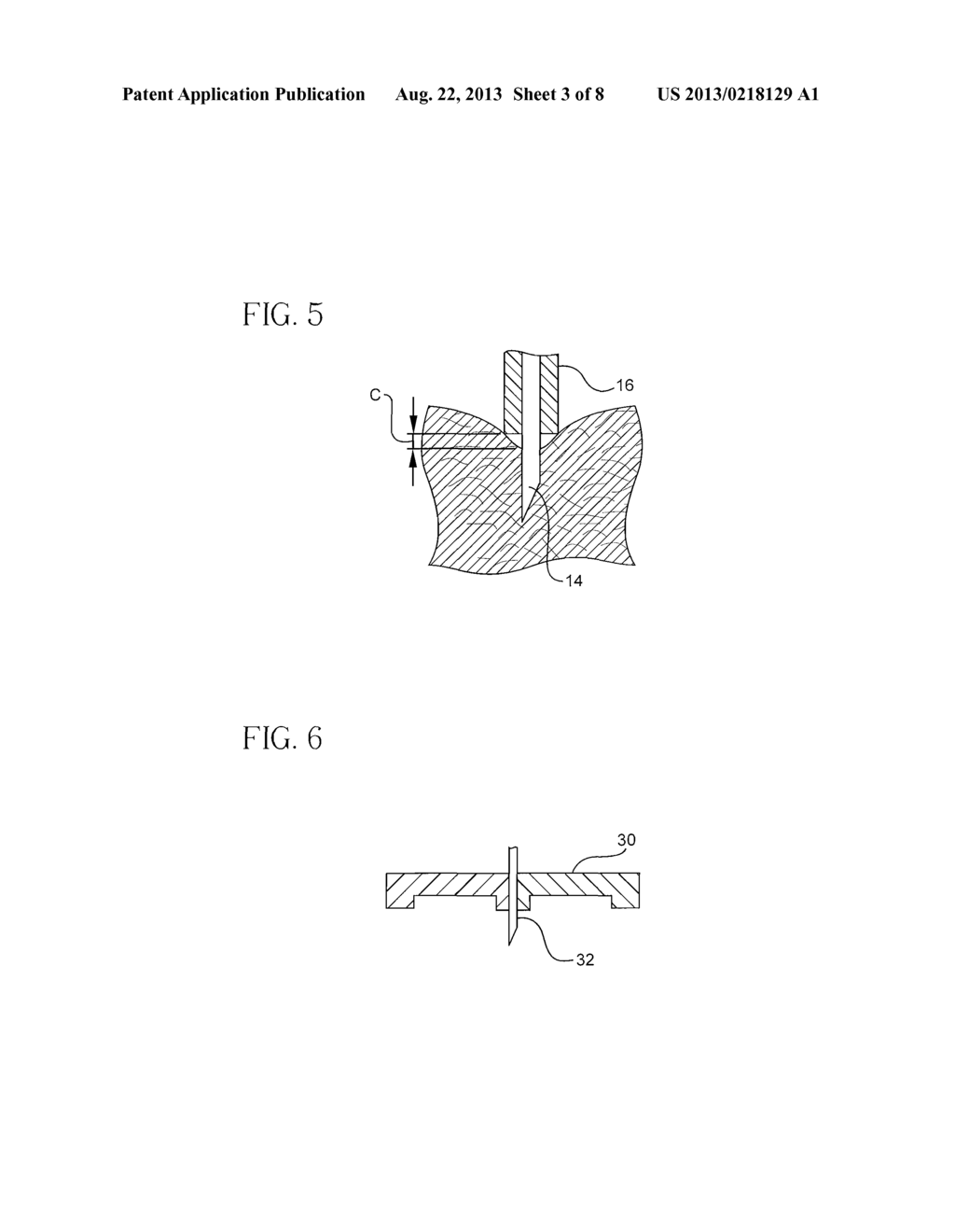 Intradermal Delivery Device - diagram, schematic, and image 04