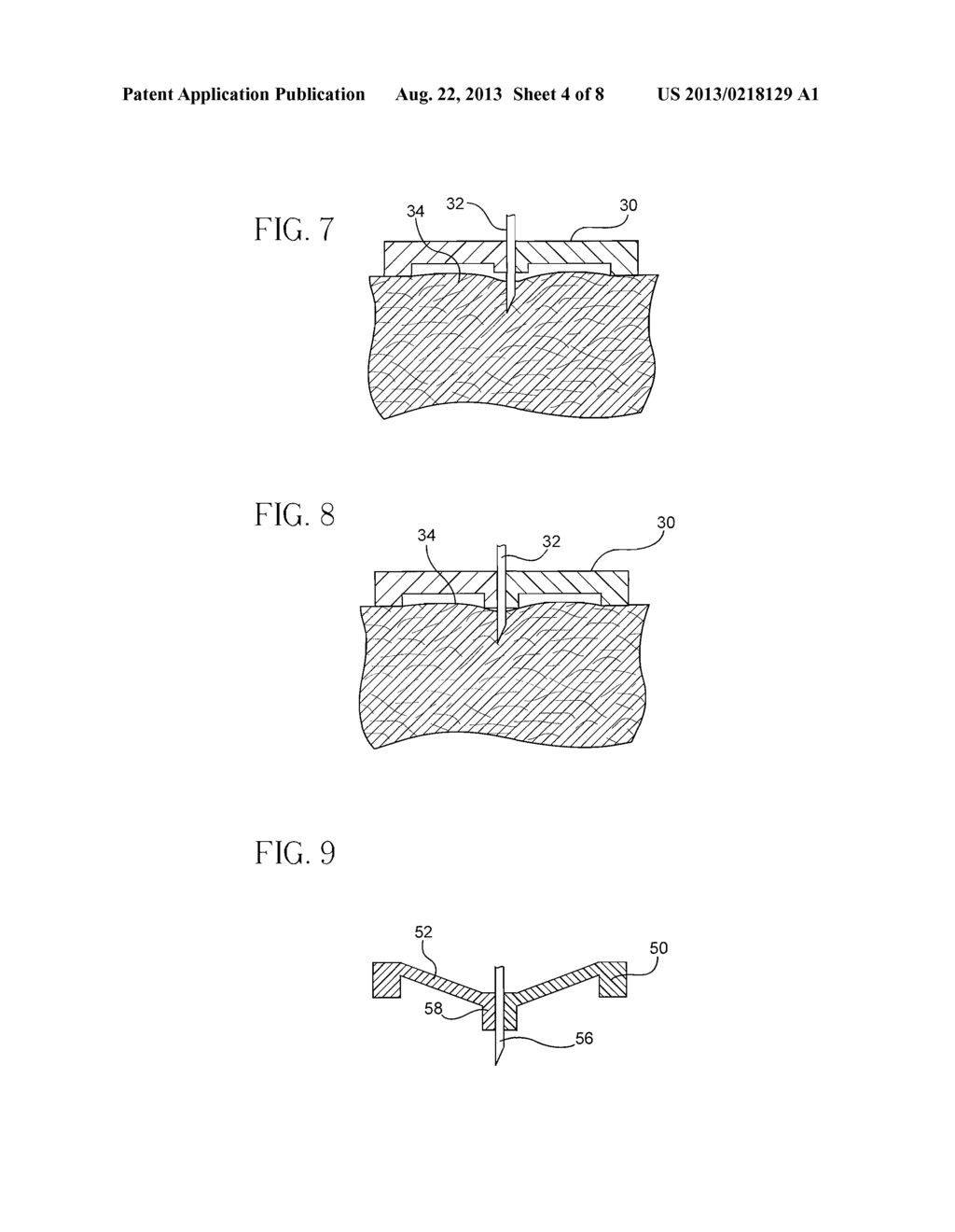 Intradermal Delivery Device - diagram, schematic, and image 05