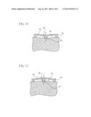 Intradermal Delivery Device diagram and image