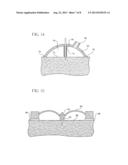 Intradermal Delivery Device diagram and image