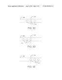 SYSTEMS AND METHODS FOR MAKING AND USING IMPLANTABLE ELECTRICAL SYSTEMS     WITH LEADS THAT COUPLE TO MULTIPLE CONNECTOR PORTS diagram and image