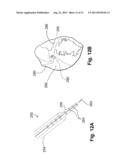 DEVICES, SYSTEMS, AND METHODS FOR EPICARDIAL NAVIGATION diagram and image