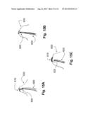 DEVICES, SYSTEMS, AND METHODS FOR EPICARDIAL NAVIGATION diagram and image