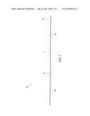 SUTURE PASSING K-WIRE diagram and image