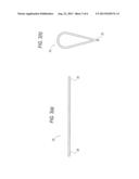 SUTURE PASSING K-WIRE diagram and image