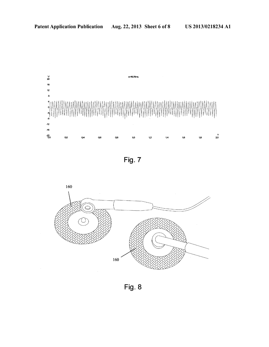 APPARATUS AND METHOD FOR RAPID SUPPRESSION OF NEUROPATHIC, ONCOLOGICAL,     AND PAEDIATRIC PAIN - diagram, schematic, and image 07