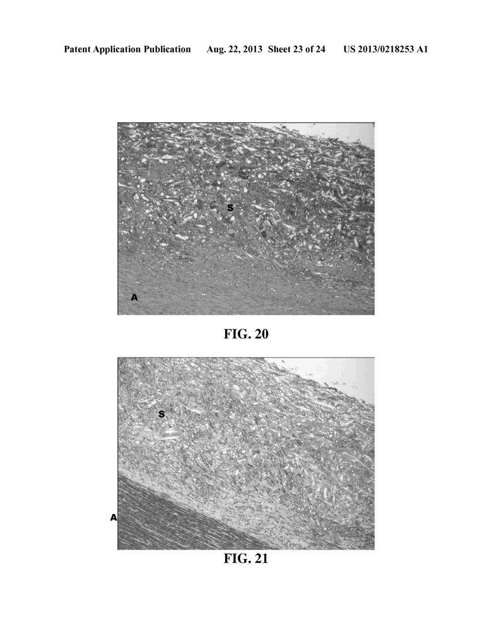 SCAFFOLD SYSTEM FOR TISSUE REPAIR - diagram, schematic, and image 24