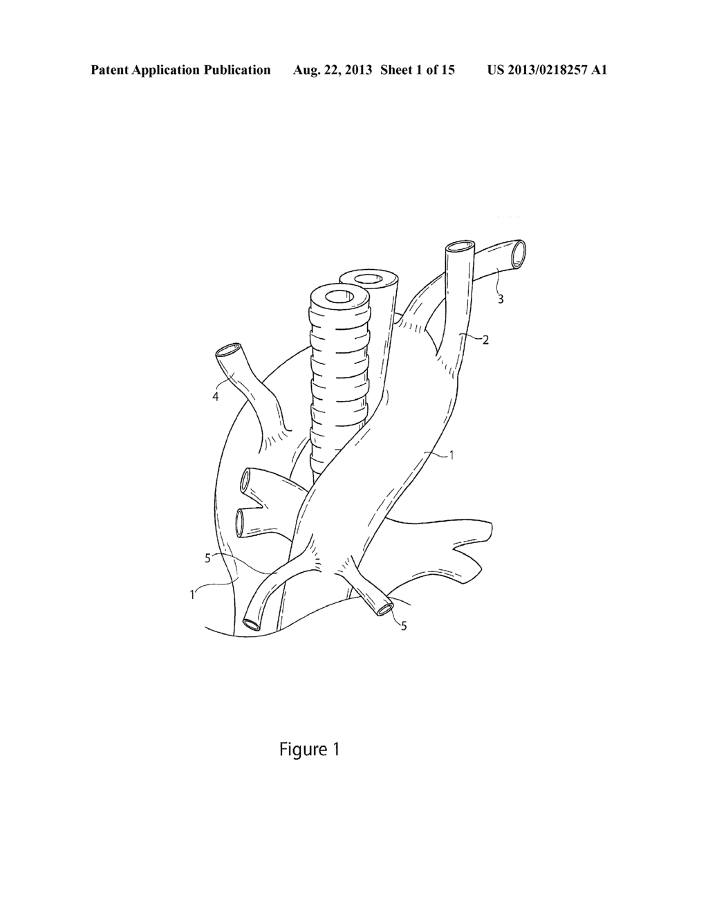 MEDICAL DEVICE DELIVERY SYSTEM AND DEPLOYMENT METHOD - diagram, schematic, and image 02