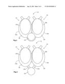 HEART ASSISTANCE DEVICE diagram and image