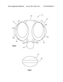 HEART ASSISTANCE DEVICE diagram and image