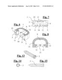 INTERVERTEBRAL IMPLANT WITH IMPROVED FASTENING SYSTEM FOR THE FIXING PLATE diagram and image