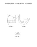 SYSTEMS AND METHODS FOR PROVIDING AN ASYMMETRICAL TIBIAL COMPONENT diagram and image