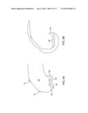 SYSTEMS AND METHODS FOR PROVIDING AN ASYMMETRICAL TIBIAL COMPONENT diagram and image