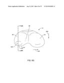 SYSTEMS AND METHODS FOR PROVIDING AN ASYMMETRICAL TIBIAL COMPONENT diagram and image