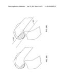 SYSTEMS AND METHODS FOR PROVIDING AN ASYMMETRICAL TIBIAL COMPONENT diagram and image