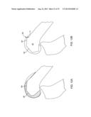 SYSTEMS AND METHODS FOR PROVIDING AN ASYMMETRICAL TIBIAL COMPONENT diagram and image