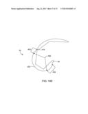 SYSTEMS AND METHODS FOR PROVIDING AN ASYMMETRICAL TIBIAL COMPONENT diagram and image