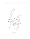 SYSTEMS AND METHODS FOR PROVIDING AN ASYMMETRICAL TIBIAL COMPONENT diagram and image