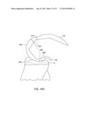 SYSTEMS AND METHODS FOR PROVIDING AN ASYMMETRICAL TIBIAL COMPONENT diagram and image