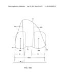 SYSTEMS AND METHODS FOR PROVIDING AN ASYMMETRICAL TIBIAL COMPONENT diagram and image