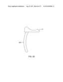 SYSTEMS AND METHODS FOR PROVIDING AN ASYMMETRICAL TIBIAL COMPONENT diagram and image