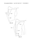 SYSTEMS AND METHODS FOR PROVIDING AN ASYMMETRICAL TIBIAL COMPONENT diagram and image