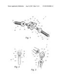 ARTIFICIAL JOINT diagram and image