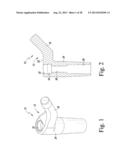 REVISION HIP PROSTHESIS HAVING AN IMPLANTABLE DISTAL STEM COMPONENT diagram and image