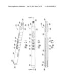 REVISION HIP PROSTHESIS HAVING AN IMPLANTABLE DISTAL STEM COMPONENT diagram and image