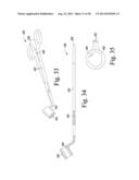 REVISION HIP PROSTHESIS HAVING AN IMPLANTABLE DISTAL STEM COMPONENT diagram and image