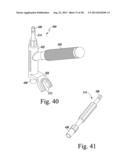 REVISION HIP PROSTHESIS HAVING AN IMPLANTABLE DISTAL STEM COMPONENT diagram and image