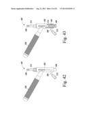 REVISION HIP PROSTHESIS HAVING AN IMPLANTABLE DISTAL STEM COMPONENT diagram and image