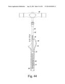 REVISION HIP PROSTHESIS HAVING AN IMPLANTABLE DISTAL STEM COMPONENT diagram and image