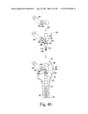 REVISION HIP PROSTHESIS HAVING AN IMPLANTABLE DISTAL STEM COMPONENT diagram and image