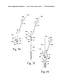 REVISION HIP PROSTHESIS HAVING AN IMPLANTABLE DISTAL STEM COMPONENT diagram and image