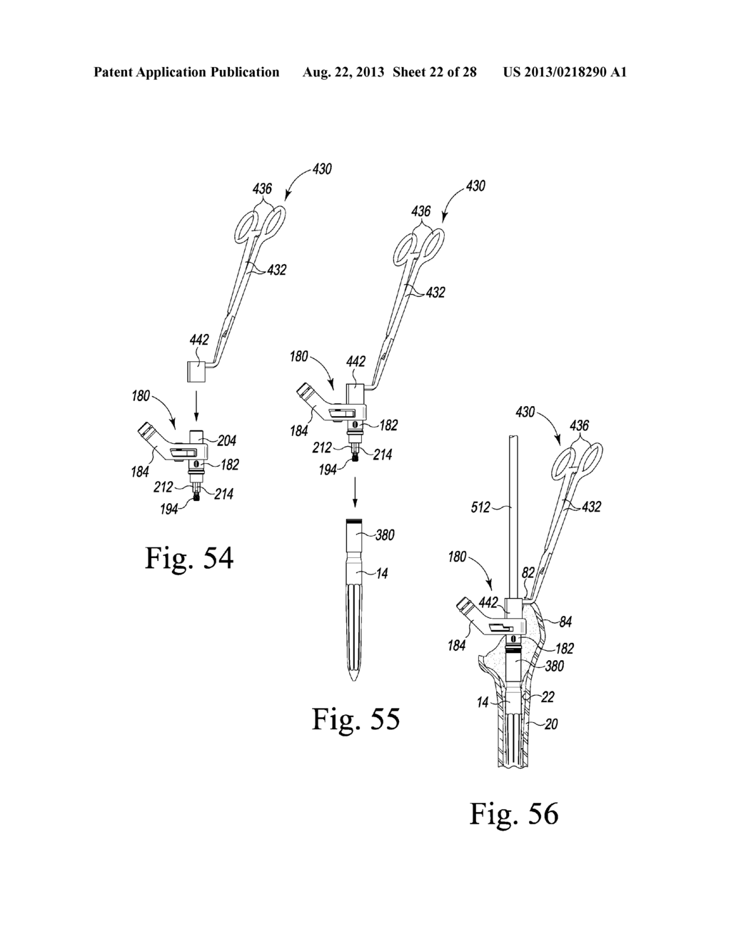 REVISION HIP PROSTHESIS HAVING AN IMPLANTABLE DISTAL STEM COMPONENT - diagram, schematic, and image 23