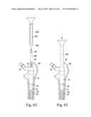 REVISION HIP PROSTHESIS HAVING AN IMPLANTABLE DISTAL STEM COMPONENT diagram and image