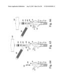 REVISION HIP PROSTHESIS HAVING AN IMPLANTABLE DISTAL STEM COMPONENT diagram and image