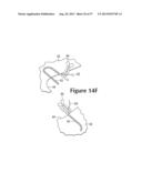 Articles Of Footwear With Tensile Strand Elements diagram and image