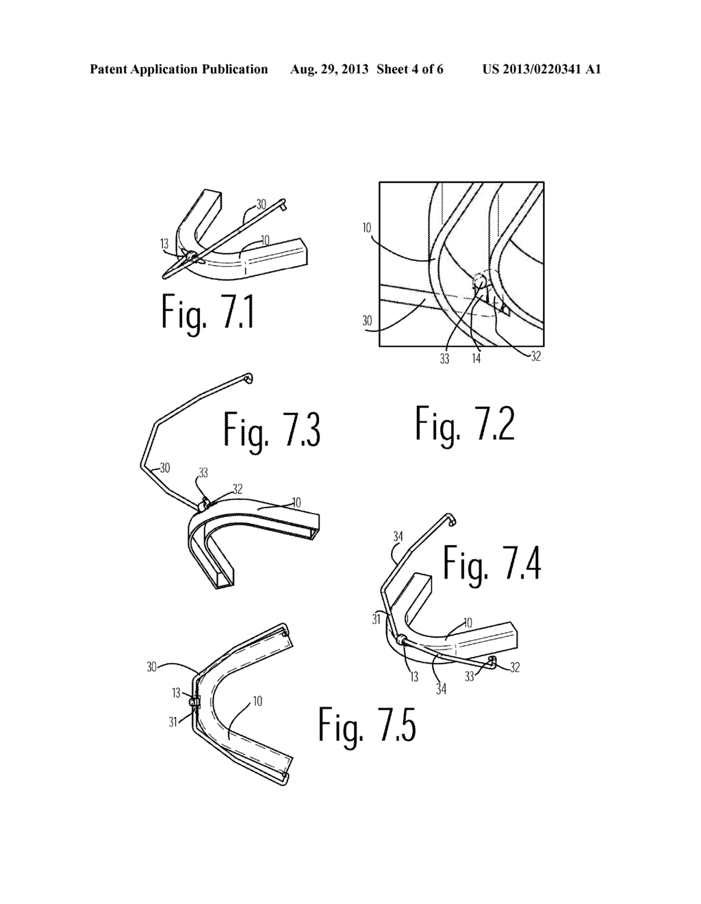 Oral Device for Improvement of Breathing - diagram, schematic, and image 05