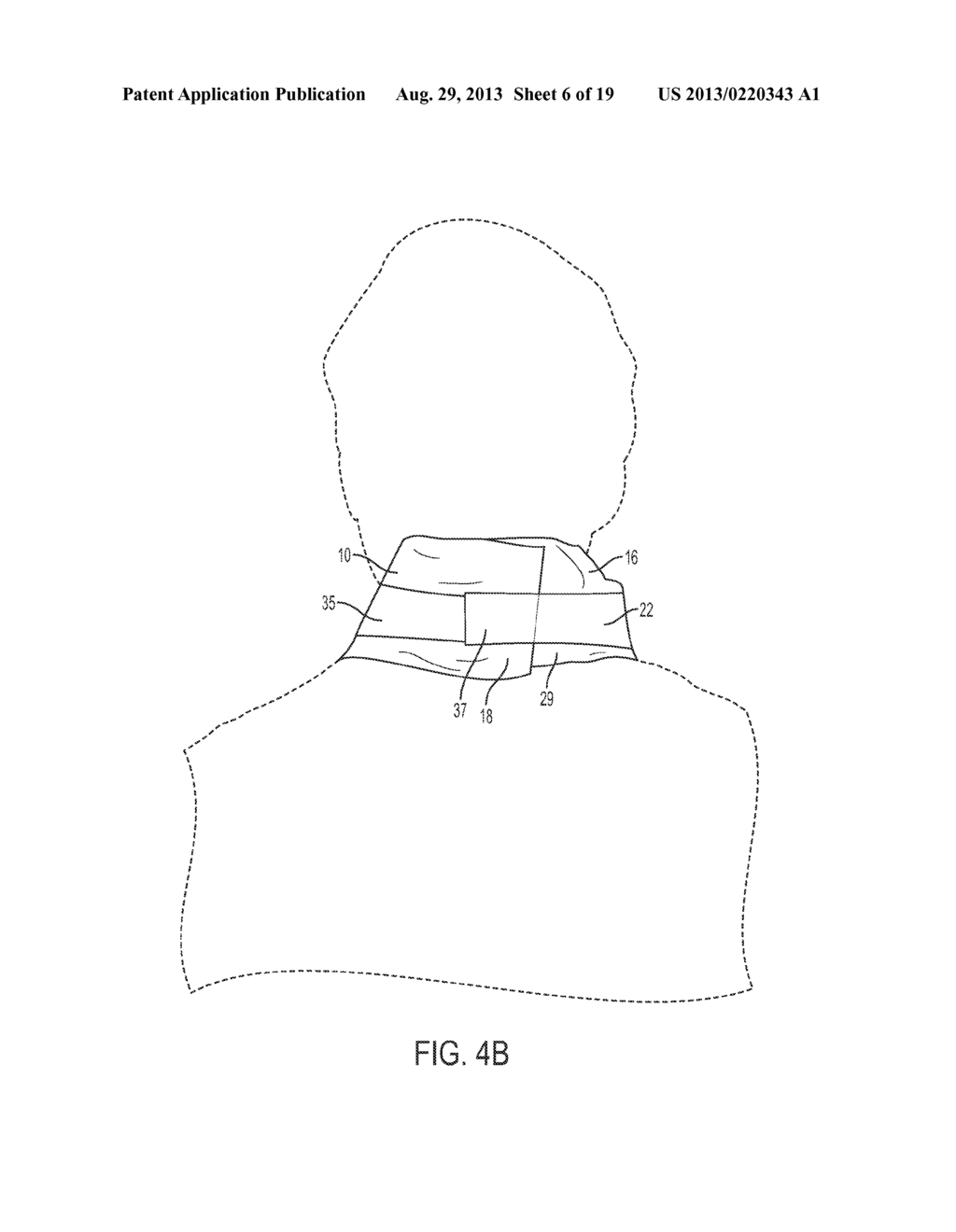 PROTECTIVE COVER FOR MEDICAL DEVICE HAVING ETCHED FASTENERS - diagram, schematic, and image 07