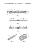 Expandable Tubing Run Through Production Tubing and Into Open Hole diagram and image