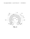 GLUE-ON HORSESHOE diagram and image