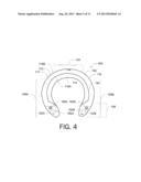 GLUE-ON HORSESHOE diagram and image